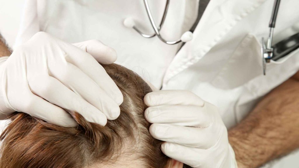 פסוריאזיס בקרקפת